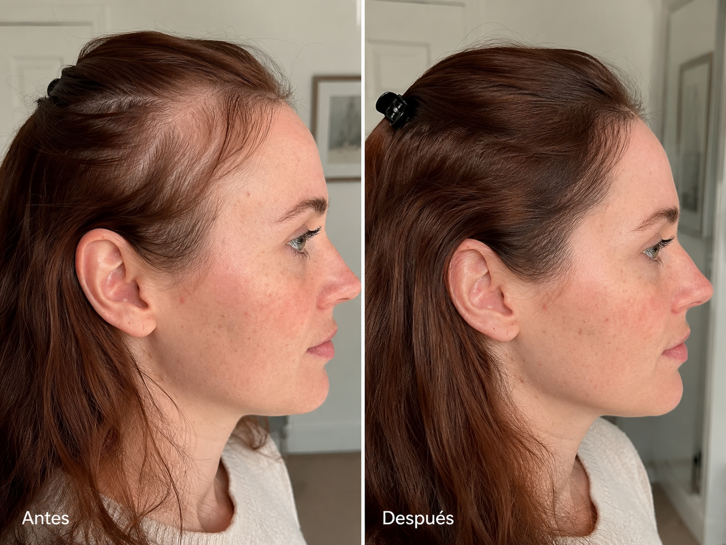 Inicio Folinove Comparativa cosmética antes y después de la rutina Folinove tras un uso continuado
